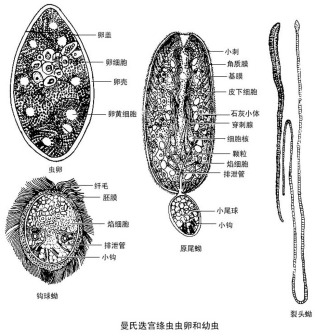 绦虫