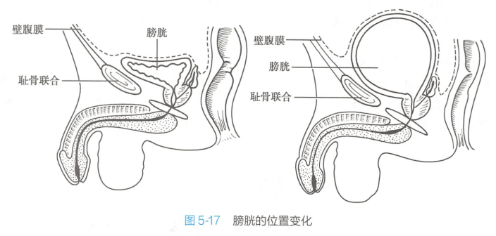 膀胱空虚时、充盈时的形态与位置变化(示前列腺)
