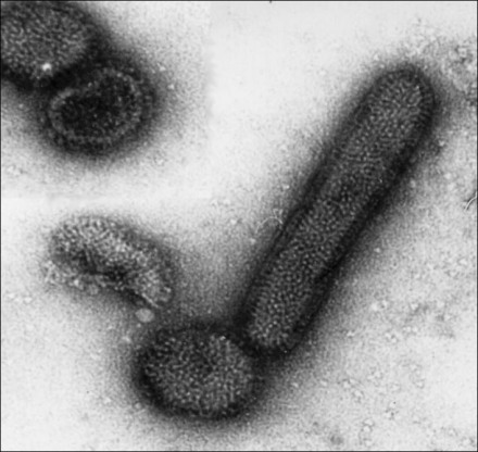 负染色透射电镜 ×175000