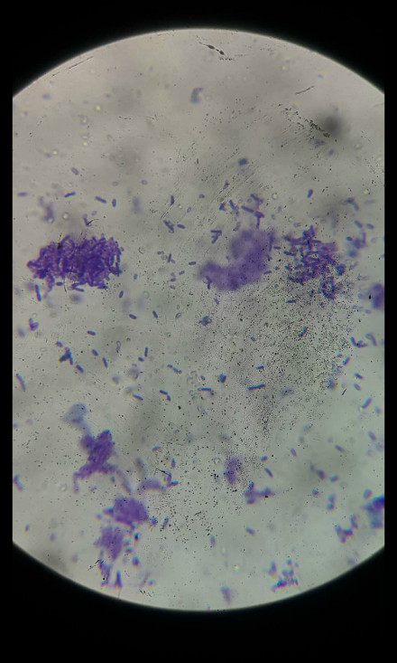 美蓝染色100倍油镜下的枯草芽孢杆菌