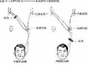 神经病学治疗图谱