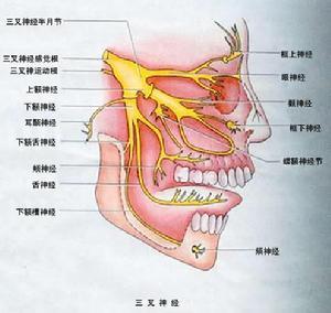 三叉神经痛图谱