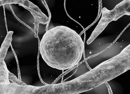 绵羊髓鞘脱落病毒