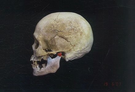 瓦石悬棺出土头骨