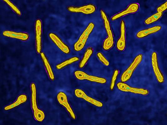 破伤风梭菌 破伤风梭菌