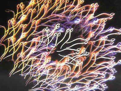 精子活力低 精子活力低