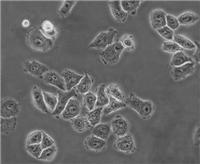 大鼠神经胶质细胞株瘤杂交瘤细胞株