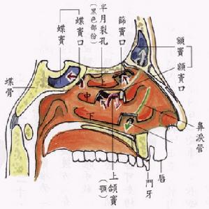 治疗呼吸道感染