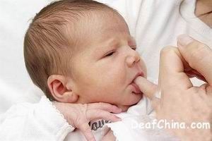 巴特综合症